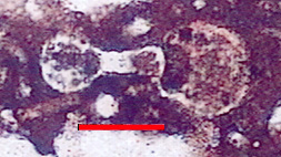 Microphotograph of Planomalinidae