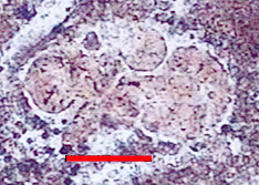 Microphotograph of Globotruncanidae